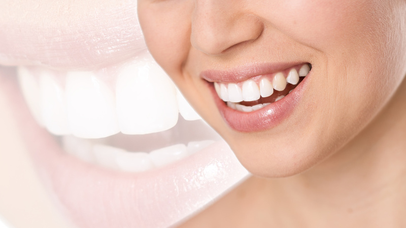 Alignment Issues: Does Your Smile Need Orthodontic Treatment in Vancouver, WA?